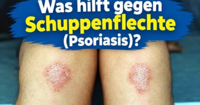 Was hilft gegen Schuppenflechte